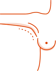 GC Aesthetics® medical illustration